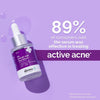 2% Salicylic Acid Serum - 30ml - Shoppiearth