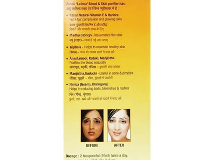 Zandu Lalima Blood And Skin Purifier Syrup