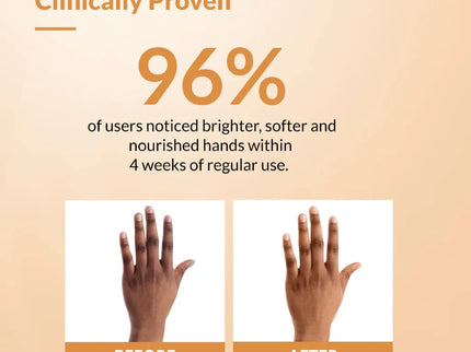 Fixderma Brightening Hand Cream - 30 gms