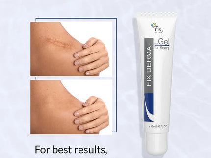 Fixderma Scar Gel for Scars - 15 ml