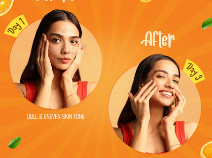 Himalaya Brightening Vitamin C Orange Face Serum Cream - 50 gms
