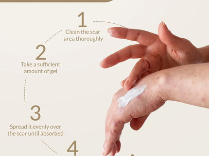 Fixderma Kelocepa Silicone Gel - 25 ml