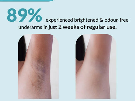 Fixderma Nigrifix Underarm Lightening Ocean Roll On - 60 ml