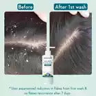 WishCare Hydrating AHA BHA Anti Dandruff Shampoo 250ml