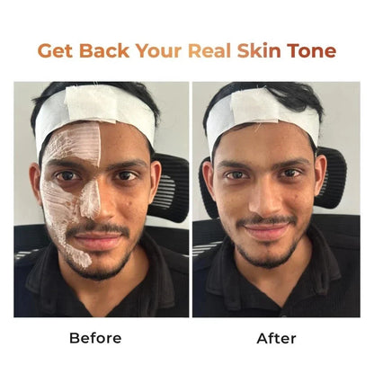 NICONI Tan Vanish Gluta-Kojic Skin Polish Helps Reduce Tan in 20 Mins 180g