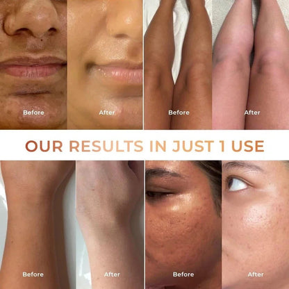 NICONI Tan Vanish Gluta-Kojic Skin Polish Helps Reduce Tan in 20 Mins 180g