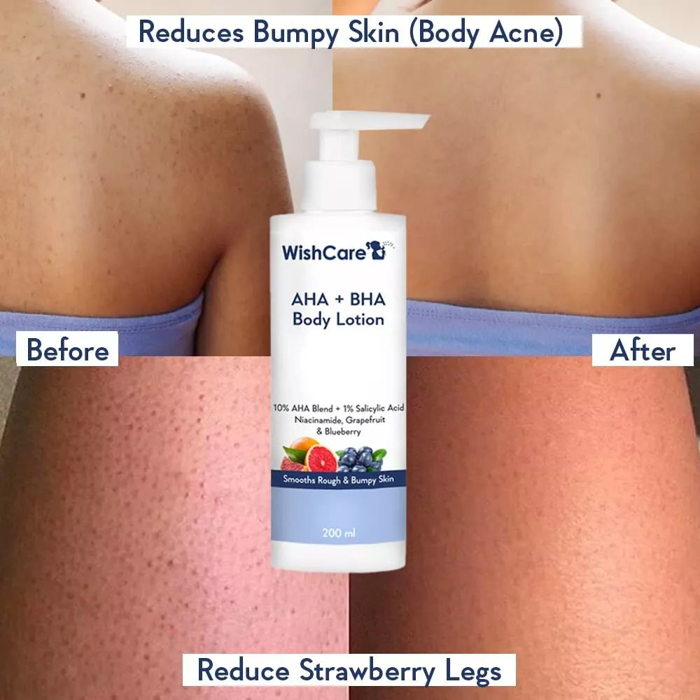 WishCare 10% AHA + 1% BHA Body Lotion Glycolic Body Lotion :- 200ml