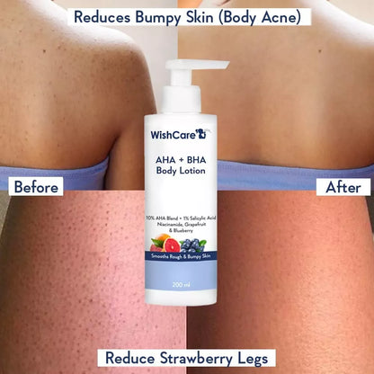 WishCare 10% AHA + 1% BHA Body Lotion Glycolic Body Lotion :- 200ml