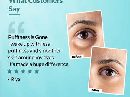 Fixderma Under Eye Roll On Cream Roll On - 15 gms